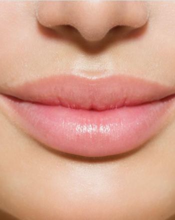 Powiększanie i modelowanie ust kwasem hialuronowym