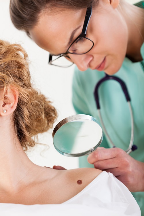 Dermatologist examining a mole with magnifying glass